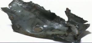 metal Object from her leg