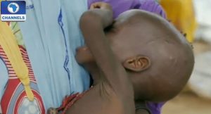 Malnutrition-in-northeast-Nigeria-Unicef