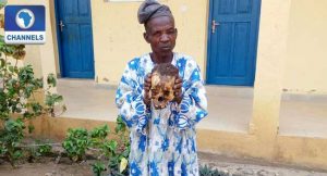 Old Man Caught With Human Skull, Says 'Na Mistake'
