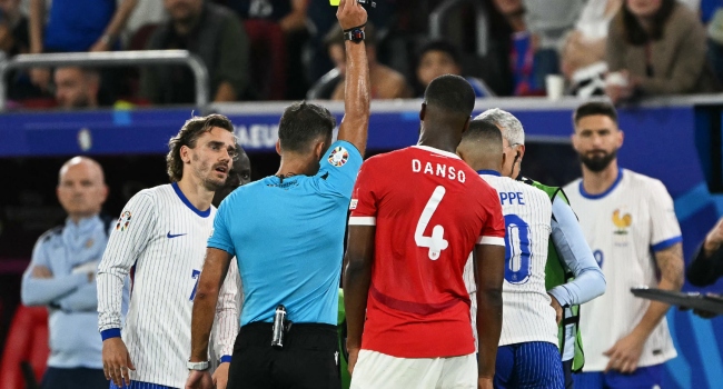 mbappe-breaks-nose-2