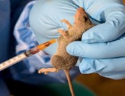 Death Toll Rises To 75, As NCDC Confirms 355 Cases Of Lassa Fever