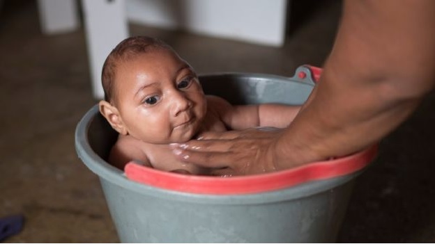 Zika Virus Triggers Pregnancy Delay Calls