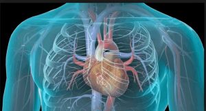 Pneumonia
