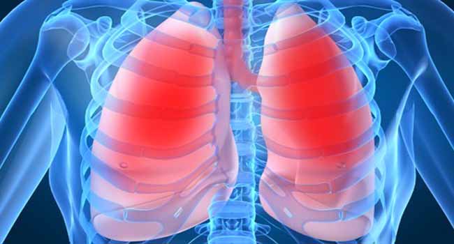 Expert Advocates More Measures To Curb Tuberculosis