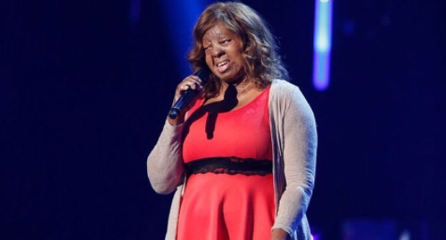 Plane Crash Survivor, Kechi Wows Judges At America’s Got Talent Finals