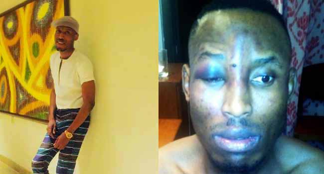 Mr 2Kay Robbed At Gun Point In Hotel Room