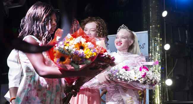 Zimbabwe’s First Ever Miss Albino Gets $85 As Star Prize