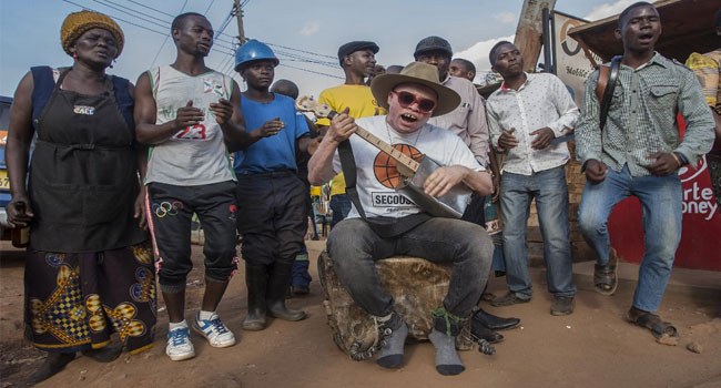 Malawi’s Albino Busker Ready For World Stage