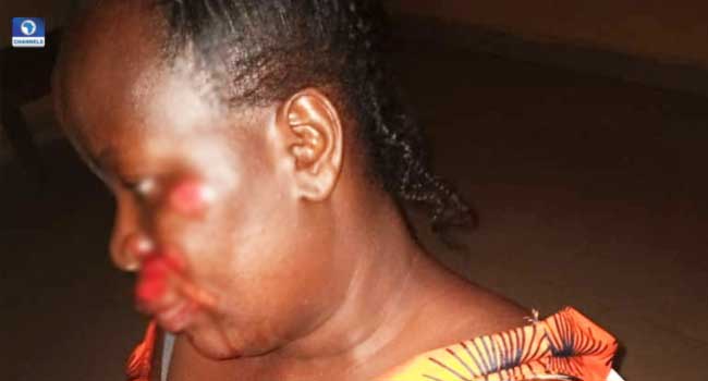 Policemen Injure Midwife In Ondo