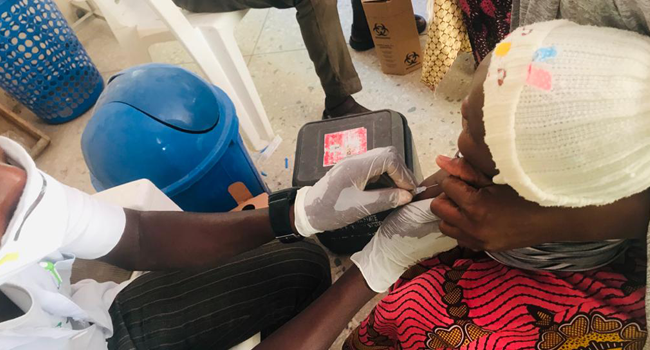 A child is being attended to by an healthcare professional in Jigawa.