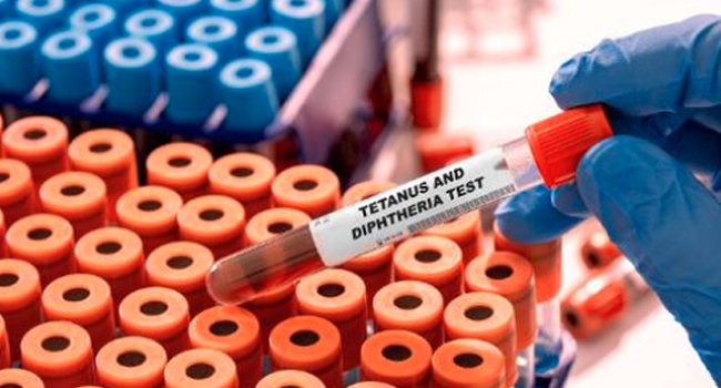 Tetanus and diphtheria blood test