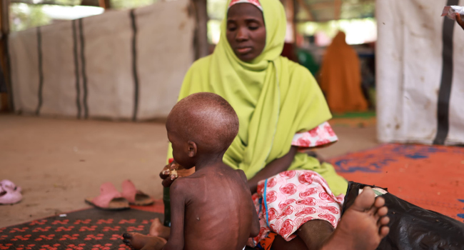 Nigeria Loses Over $1.5bn To Malnutrition Annually — FG
