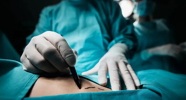 UK Seeks To Stamp Out High-Risk Cosmetic Procedures Including Brazilian Butt Lifts